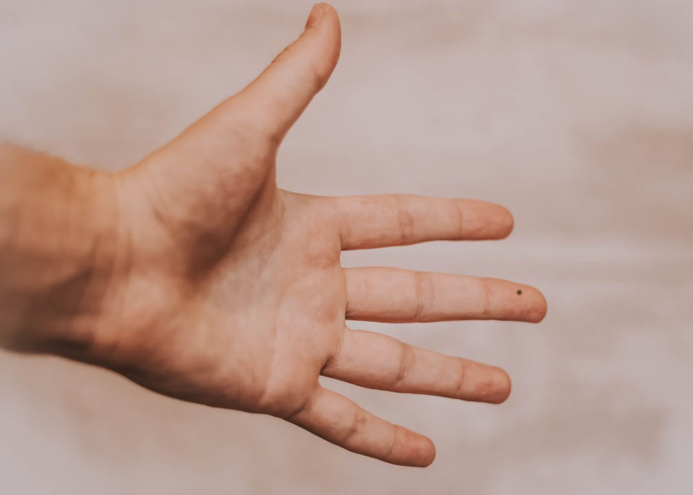 Родинка на среднем пальце левой руки – значение